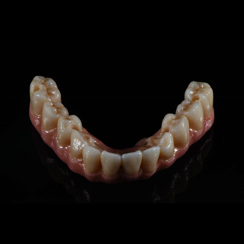 Implant Zirconia Bridge