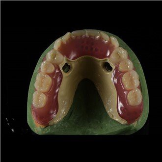 Peek Framework hniav hniav