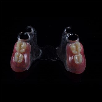 Removable Acrylic Partial Denture