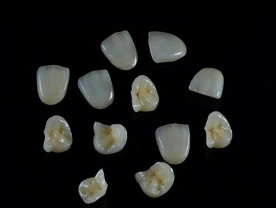 Yuav Ua Li Cas Xaiv Cov Kho Hniav Zoo Tshaj Plaws rau Crowns: Phau Ntawv Qhia...