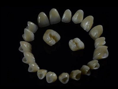 Kev Kho Hniav Lab Zirconia Crowns: Zoo, Txheej Txheem, thiab Yuav Ua Li Cas R...
