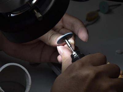 Ntev npaum li cas PFM Crowns kav ntev? Nruab Nrab Lifespan, Yam Tseem Ceeb & ...